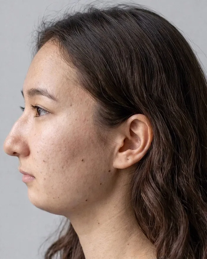 "Best Facial Harmonization I've Ever Seen": 25 Before-And-Afters By A Plastic Surgeon Whose Work Went Viral