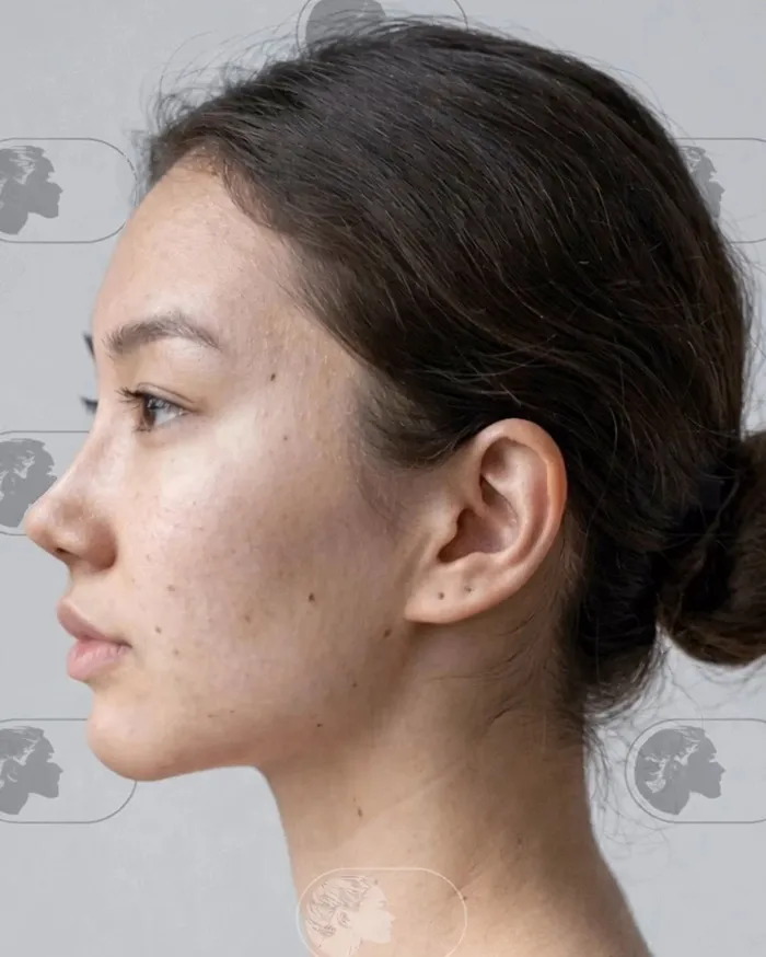 25 Personas que se ven irreconocibles tras su cirugía plástica