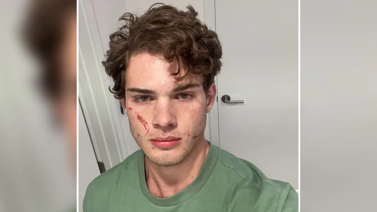 ‘Looksmaxxing’ Influencer Clavicular Breaks Silence After ‘Brutal’ Hospitalization Following Live Incident