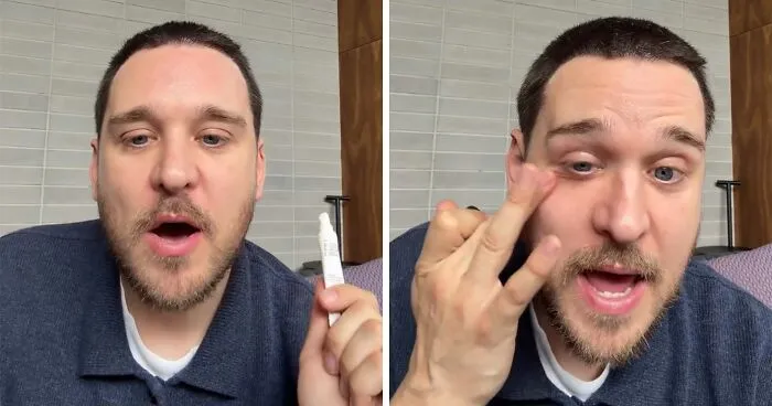 Celebrity Skincare Expert's 'Genius' Lip Balm Hack Could Save You Hundreds Per Year