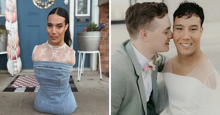 Beauty Influencer With No Limbs Answers Question “Everyone Wants To Know” About Husband