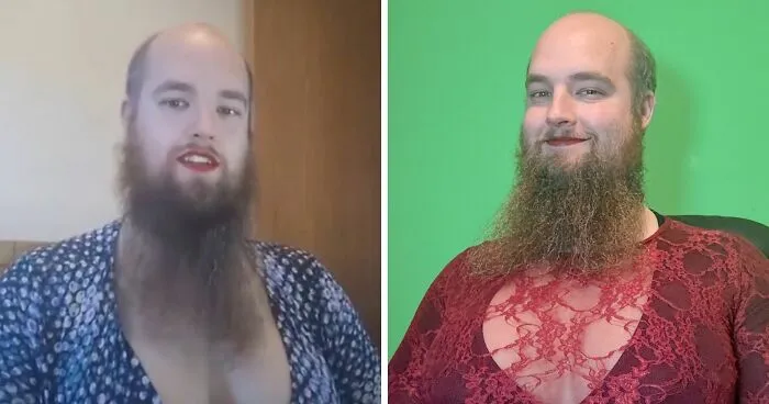 “Grossly Insulted”: Professors Call Out Oxford Over Lecturer’s Fake Breasts Outfit At Work