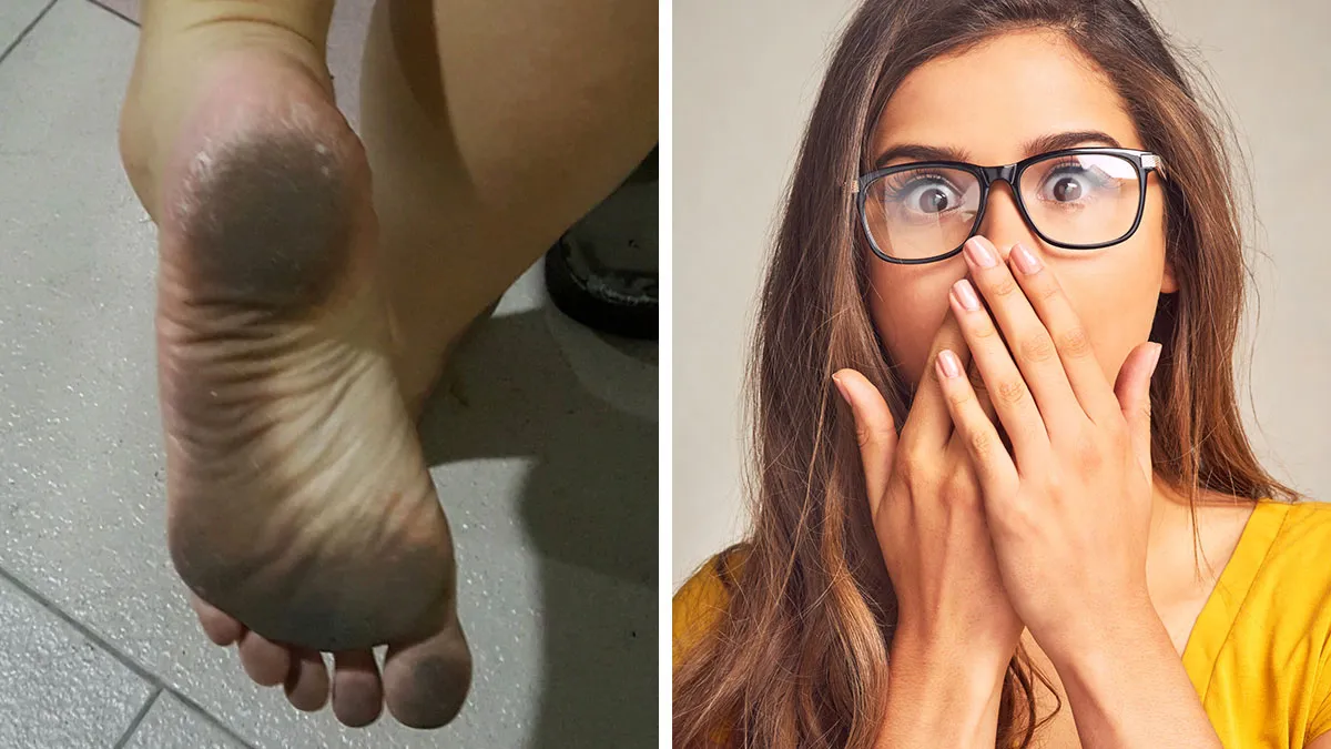 “HR Had To Get Involved”: 45 Disgusting People Who Made Their Coworkers Gag