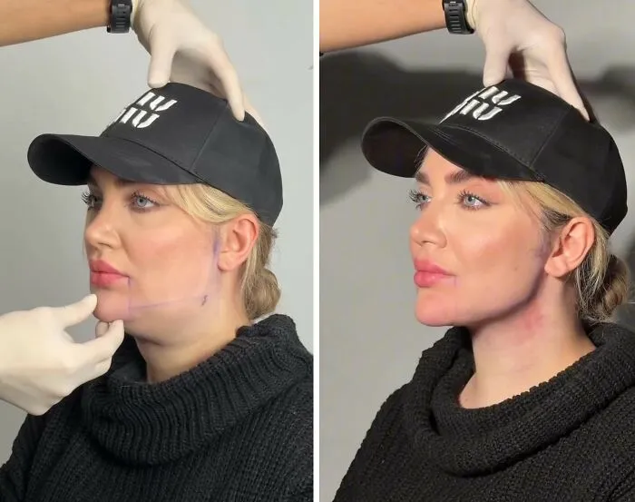 This Plastic Surgery Clinic’s Before-And-After Transformations Have Gone Viral Online (31 Pics)