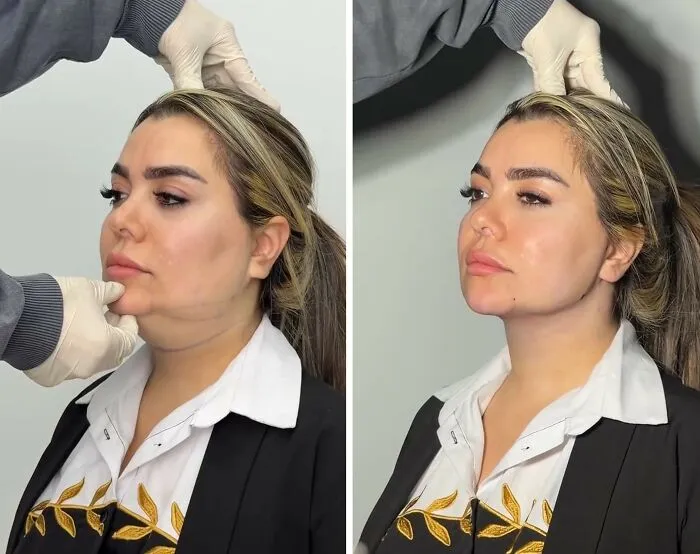 This Plastic Surgery Clinic’s Before-And-After Transformations Have Gone Viral Online (31 Pics)