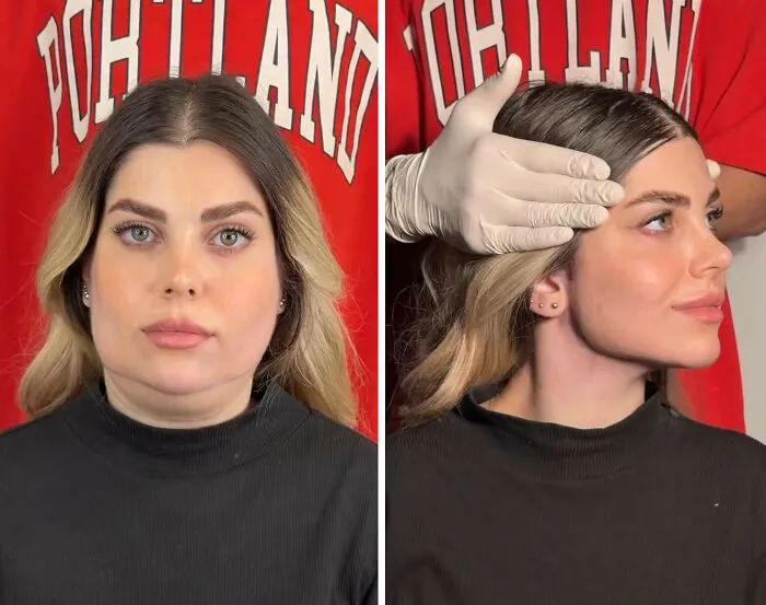 This Plastic Surgery Clinic’s Before-And-After Transformations Have Gone Viral Online (31 Pics)