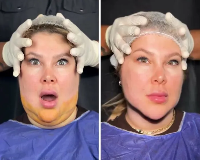 This Plastic Surgery Clinic’s Before-And-After Transformations Have Gone Viral Online (31 Pics)