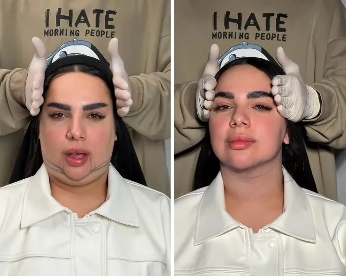 This Plastic Surgery Clinic’s Before-And-After Transformations Have Gone Viral Online (31 Pics)