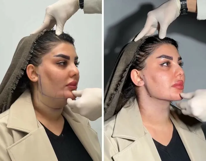 This Plastic Surgery Clinic’s Before-And-After Transformations Have Gone Viral Online (31 Pics)