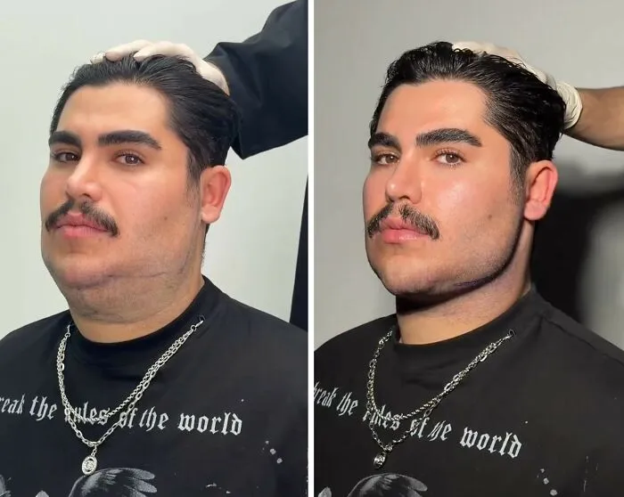 This Plastic Surgery Clinic’s Before-And-After Transformations Have Gone Viral Online (31 Pics)