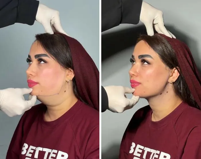 This Plastic Surgery Clinic’s Before-And-After Transformations Have Gone Viral Online (31 Pics)