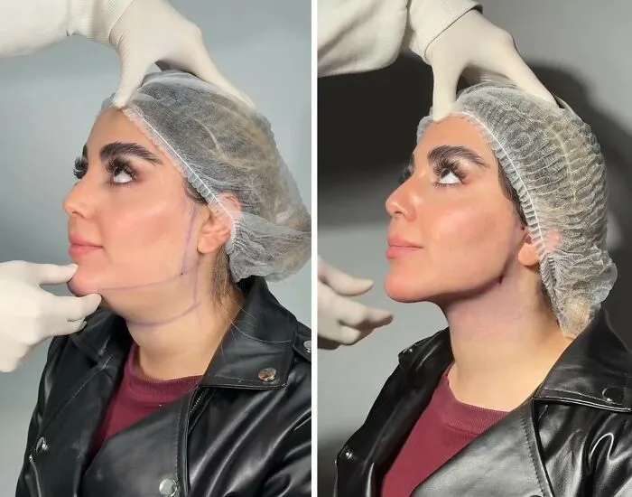 This Plastic Surgery Clinic’s Before-And-After Transformations Have Gone Viral Online (31 Pics)