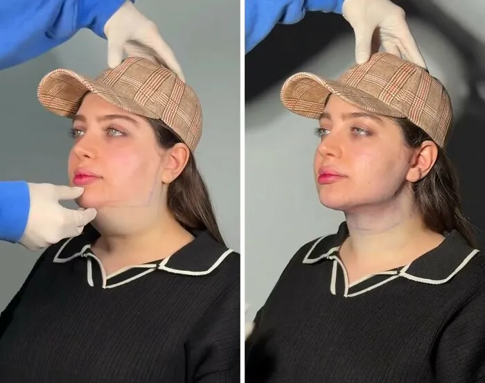 This Plastic Surgery Clinic’s Before-And-After Transformations Have Gone Viral Online (31 Pics)