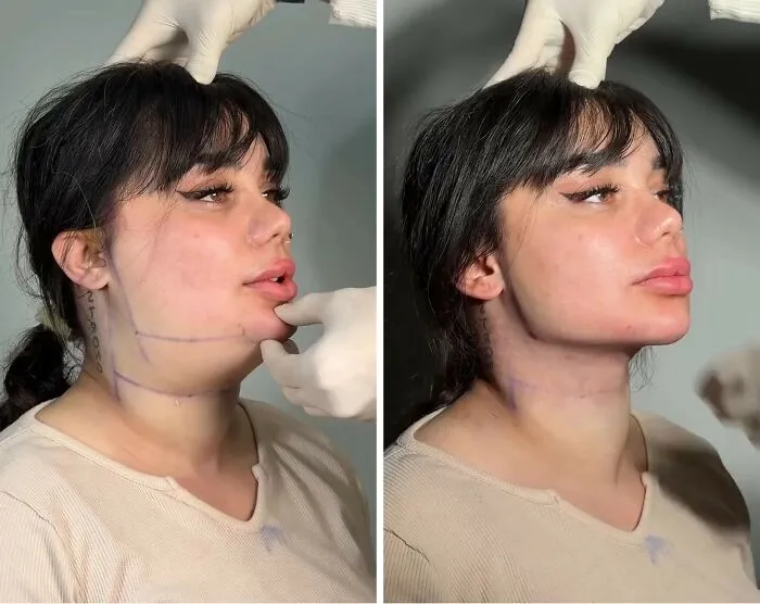 This Plastic Surgery Clinic’s Before-And-After Transformations Have Gone Viral Online (31 Pics)