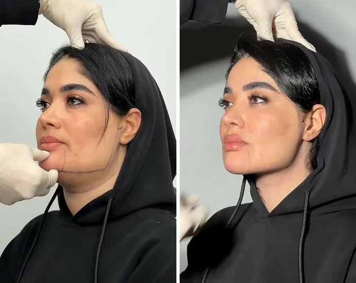 This Plastic Surgery Clinic’s Before-And-After Transformations Have Gone Viral Online (31 Pics)