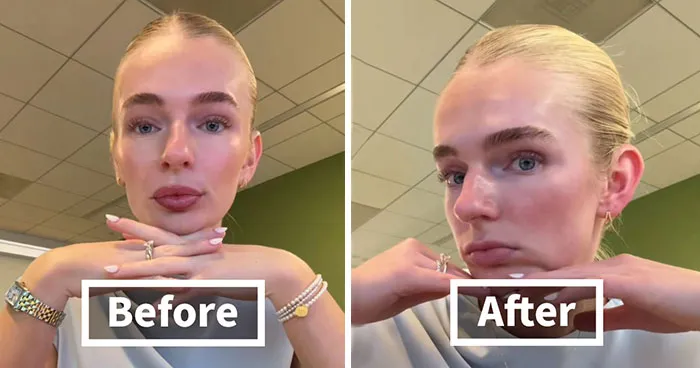 “A Victim Of Office Air”: People Reveal The Glow-Downs That They Experience After A Day In The Office