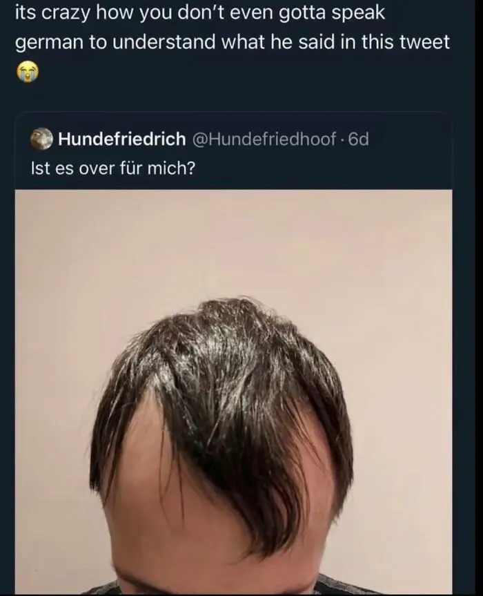 A person with a terrible haircut in a tweet asking "Ist es over für mich?", a rare burn.