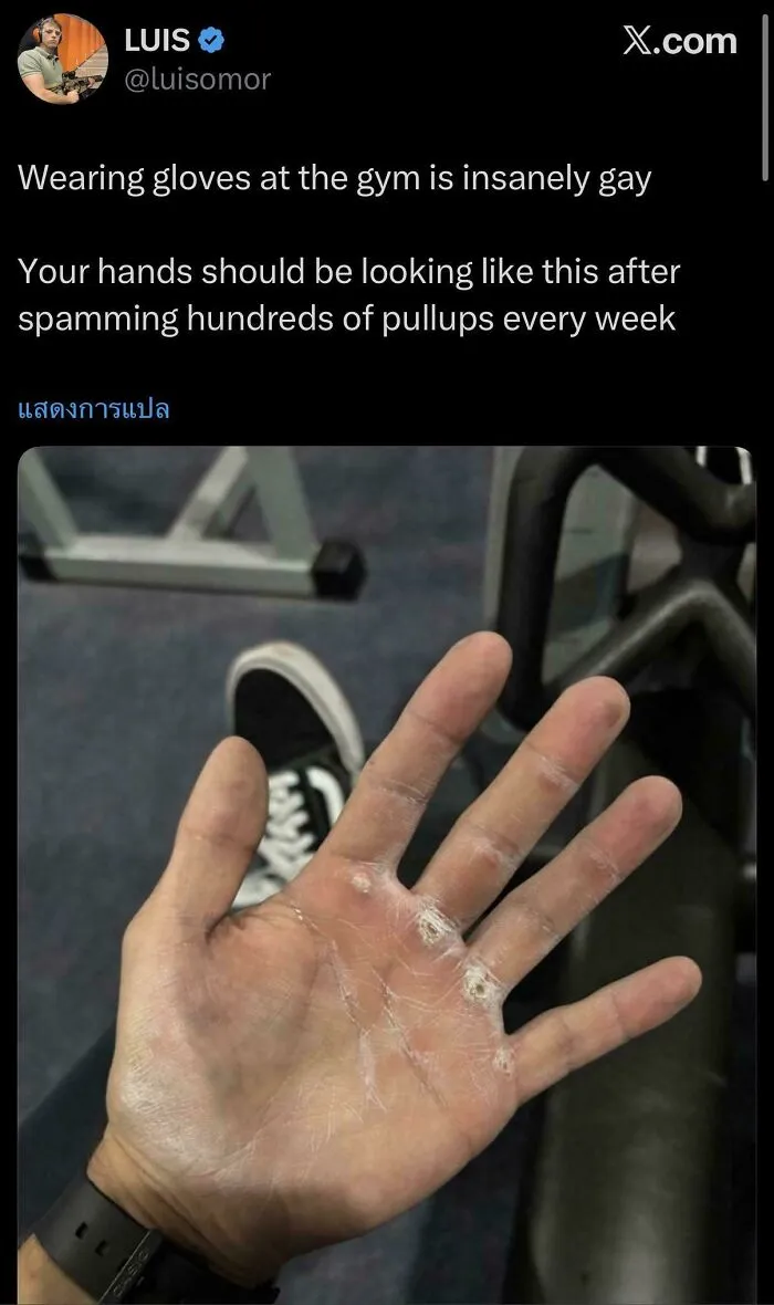 Fix Your Pull Up Technique And This Will Go Away  