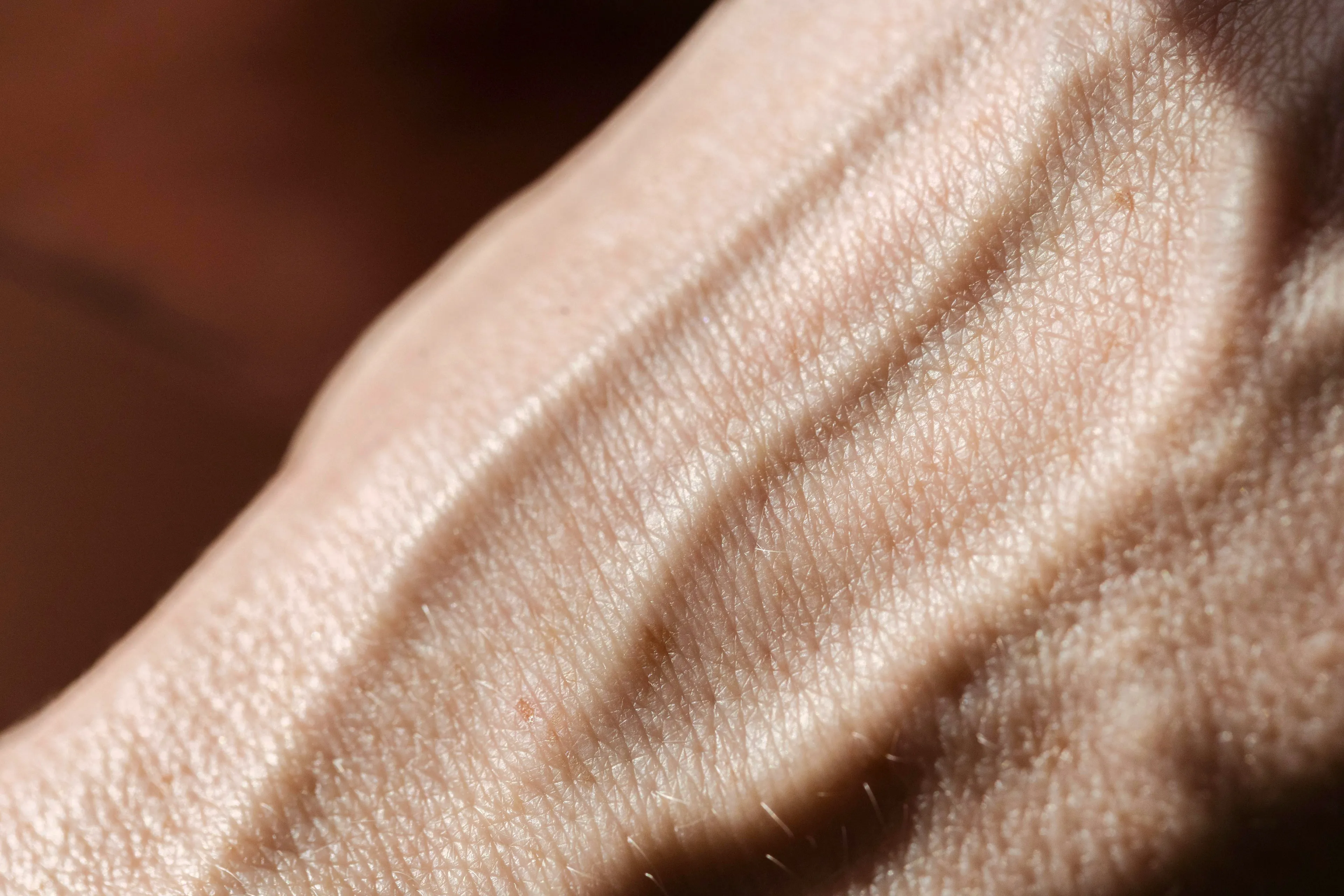 Close-up of human skin showing veins under the surface, highlighting the outer layer of skin and its texture.