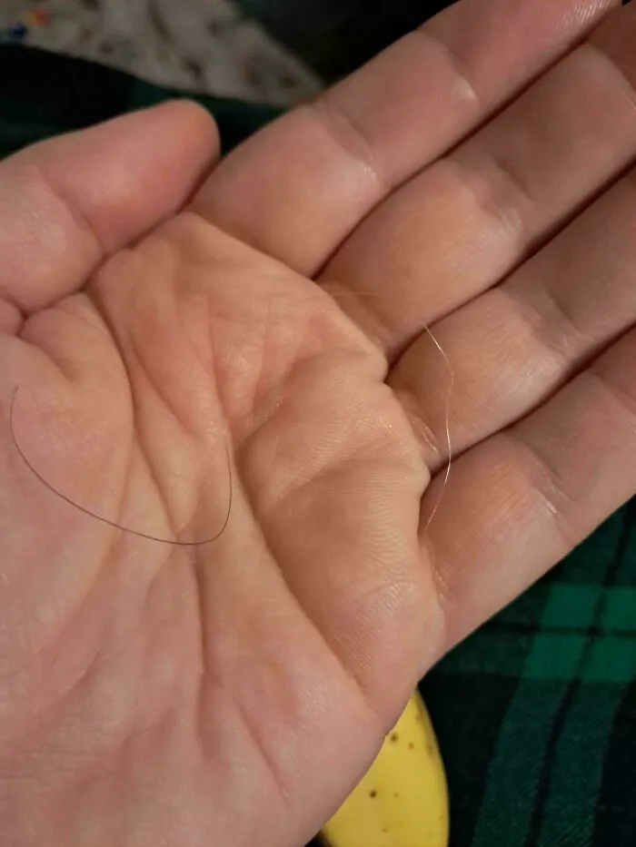 Grey Hair Turning Back To Brown