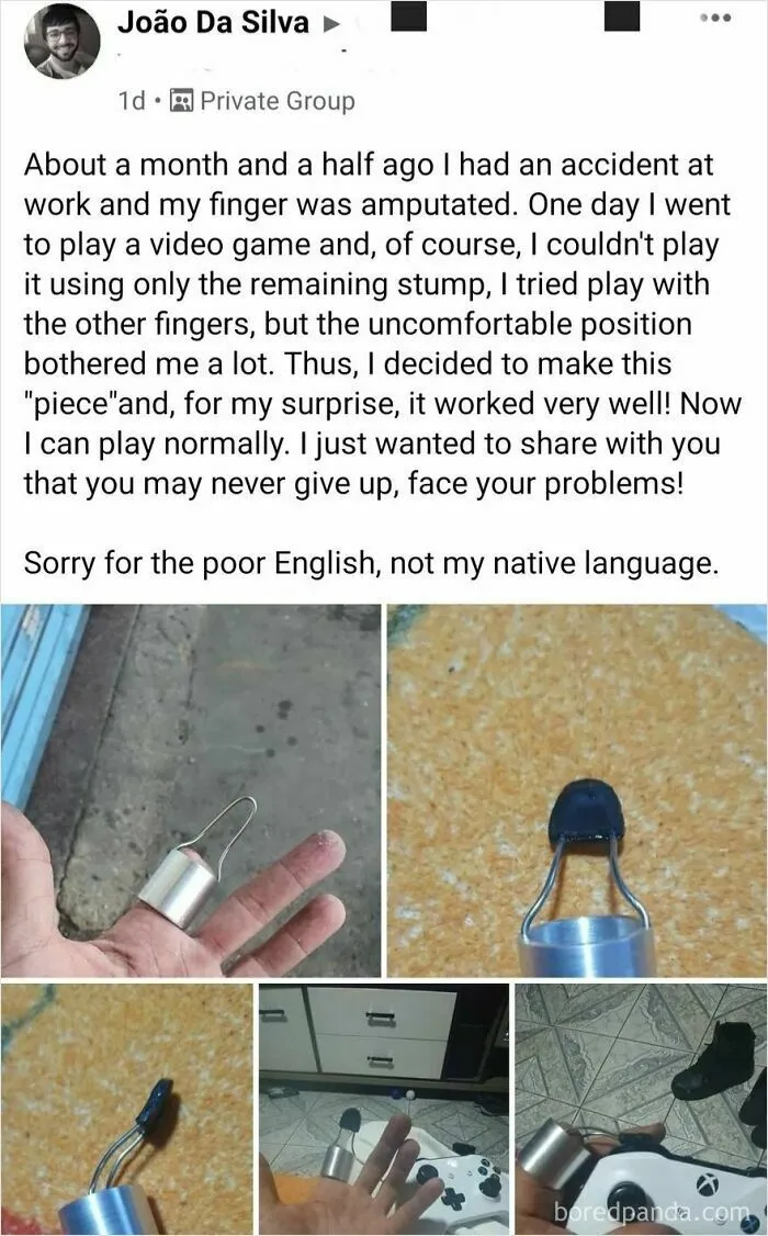 Lost Finger Can‘T Stop A Gamer