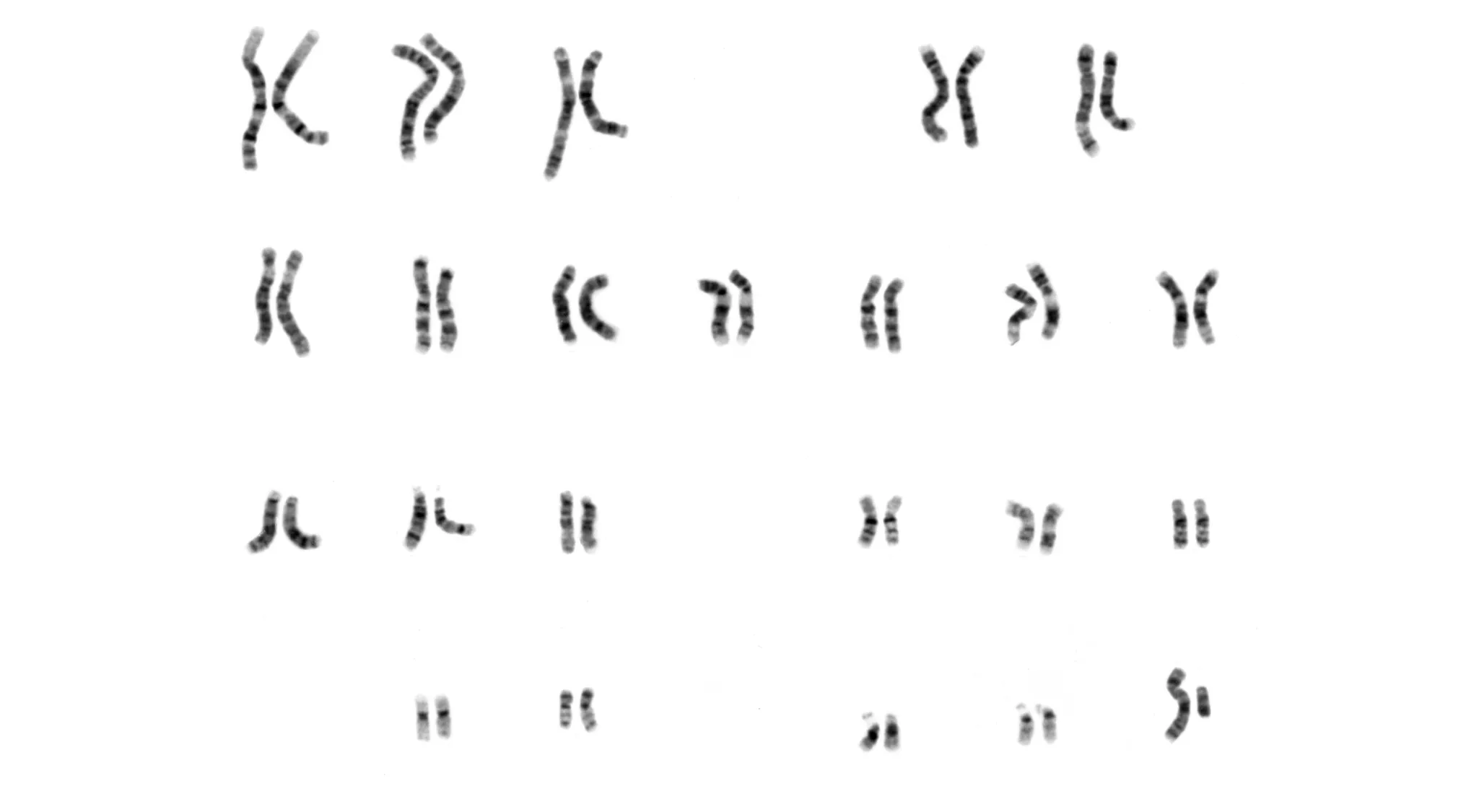 A karyotype showing 23 pairs of chromosomes, which are the main SEO keyword, arranged in homologous pairs.