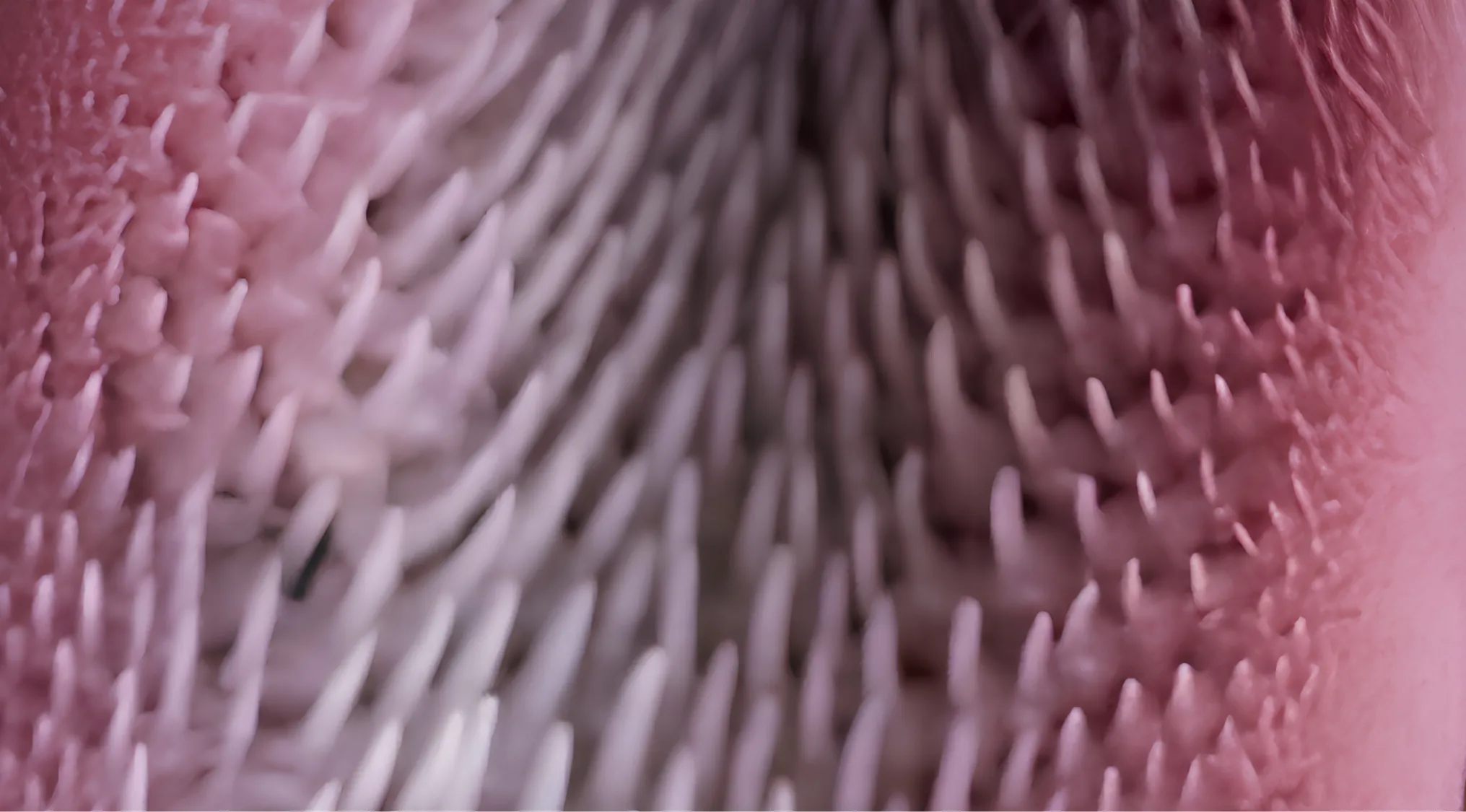 Zoomed-in images reveal a spiky texture, likely an extreme close-up of an animal's body part. Guess which one!
