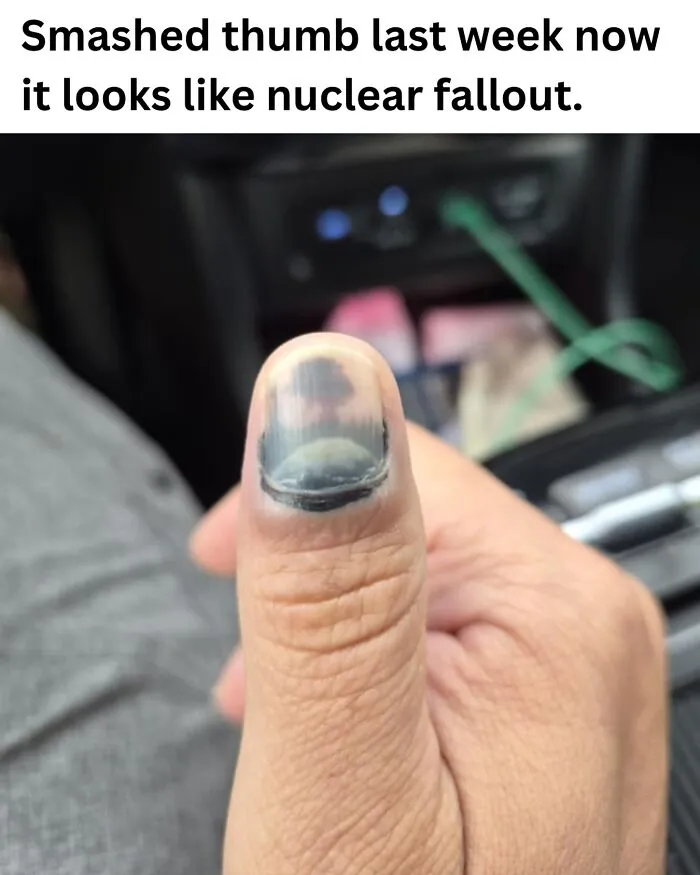 These 50 Photos May Seem Confusing At First, But The Explanation Makes Them Even Better