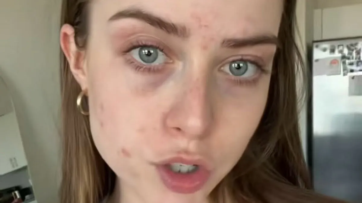 "Sugar Obsessed" Influencer Reveals Her Impressive Transformation After Cutting Out Sweets For Just Two Weeks