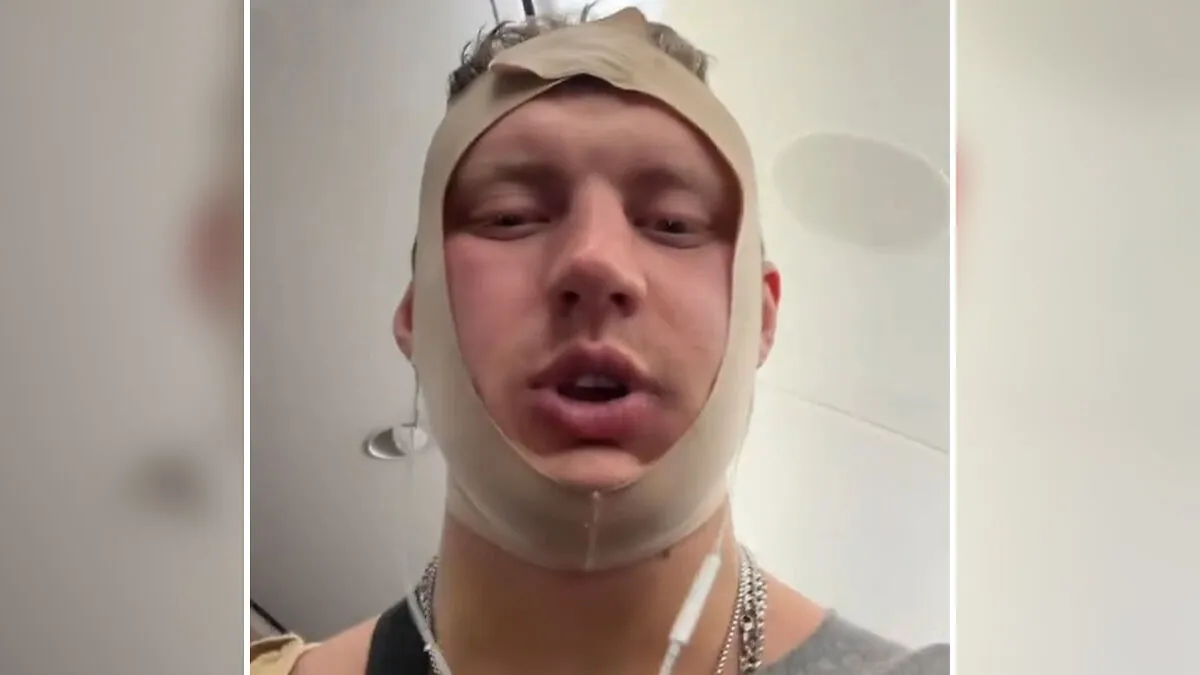 Looksmaxxer Androgenic Fights Flight Attendant And Gets Kicked Off Plane Shortly After Getting Plastic Surgery