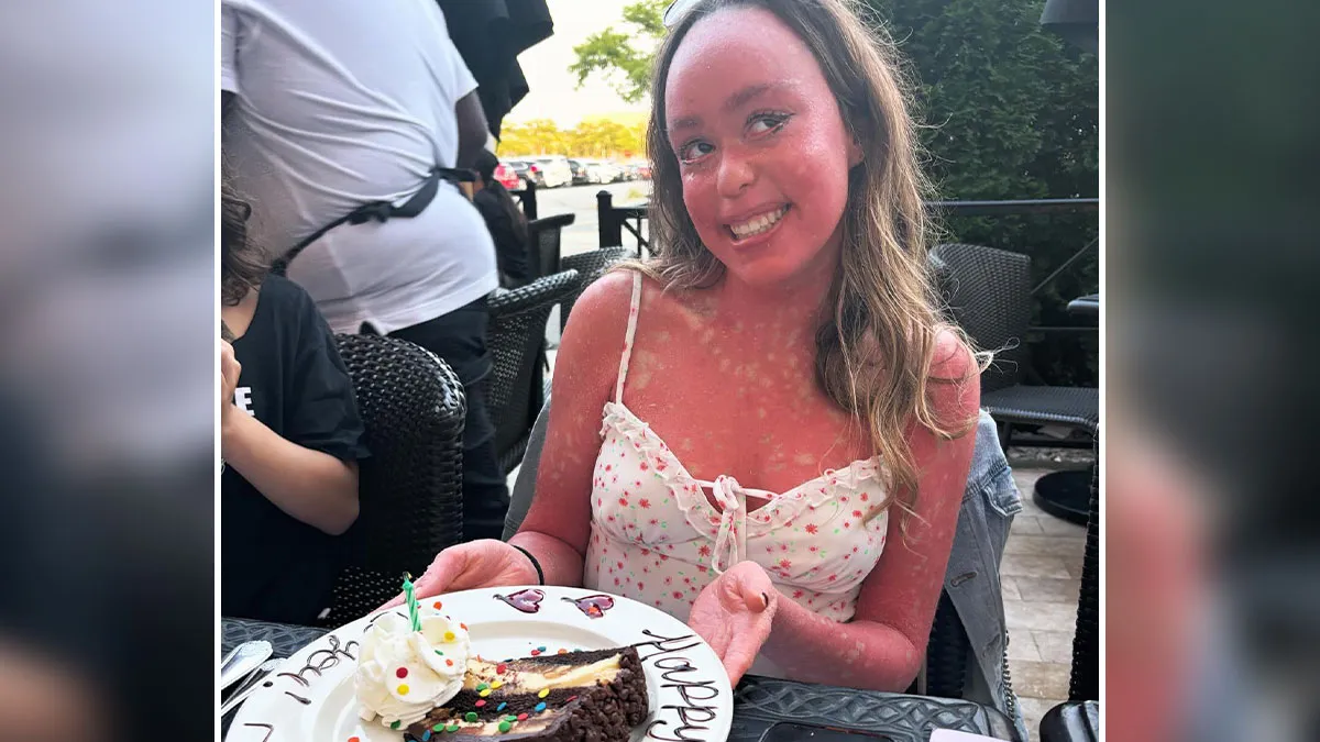 Teen Shows The Only Way She Can Control Her Rare Skin Condition, Shocks Doctors With Her Routine