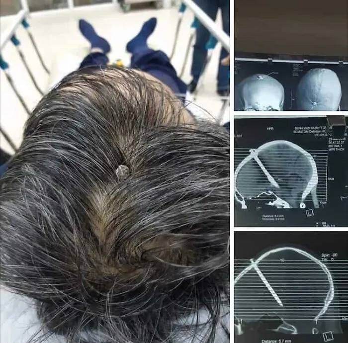 20 Fotos inquietantes que parecen completamente normales hasta que te fijas en un detalle