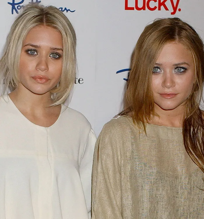 Two women posing together displaying possible buccal fat removal results