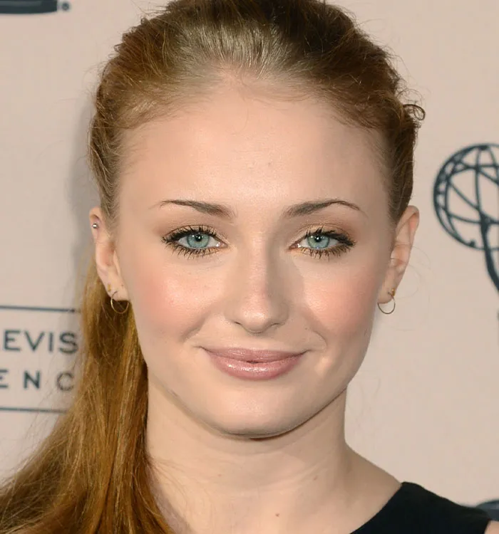 Blonde celebrity face highlighting rumored buccal fat removal changes