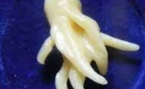 “Wife Hasn’t Eaten Eggs Since”: 83 Oddly Terrifying Images That Are Not For The Weak (New Pics)
