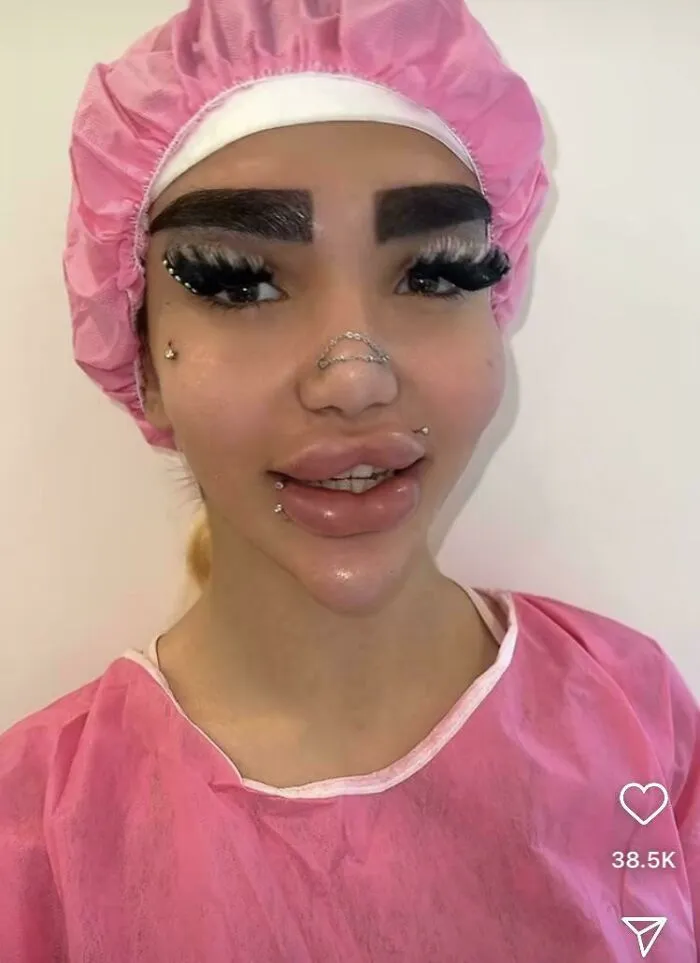 En la página de Instagram de una clínica que realiza implantes de cejas.
