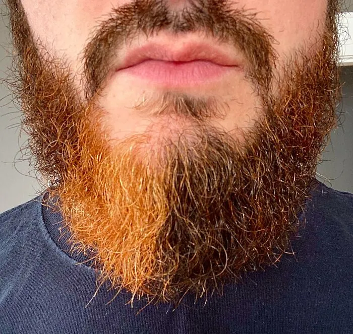 Mi barba crece de color naranja en una cuarta parte y está partida prácticamente por la mitad de mi barbilla.