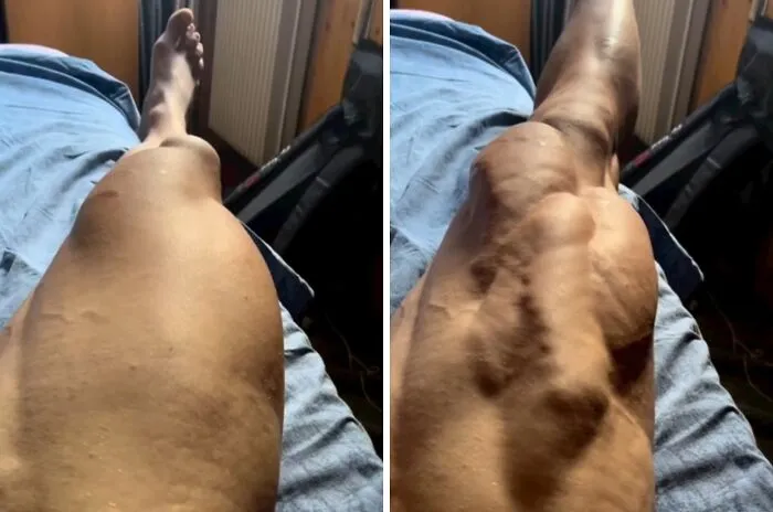 Before and after images of leg muscles contracting showing body muscle quirks