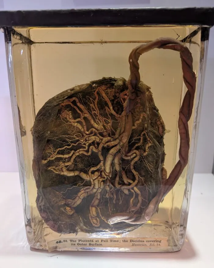 Estas no son raíces de árboles, sino el interior de una placenta humana.