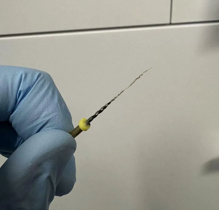 Just Cleanly Removed The Entire Nerve From My Patient’s Tooth (On Purpose)