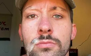 People Are Sharing How Weird Their Bodies Look Or Behave And These 61 Photos Are Fascinating (New Pics)