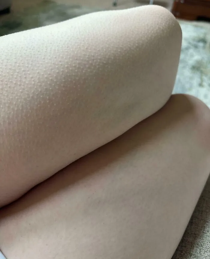 I Only Get Goosebumps On One Side Of My Body Ever Since I Had Spine Surgery