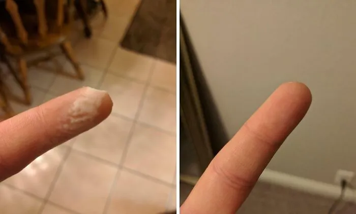 Mi cuerpo me creó una nueva punta de dedo en 30 días.
