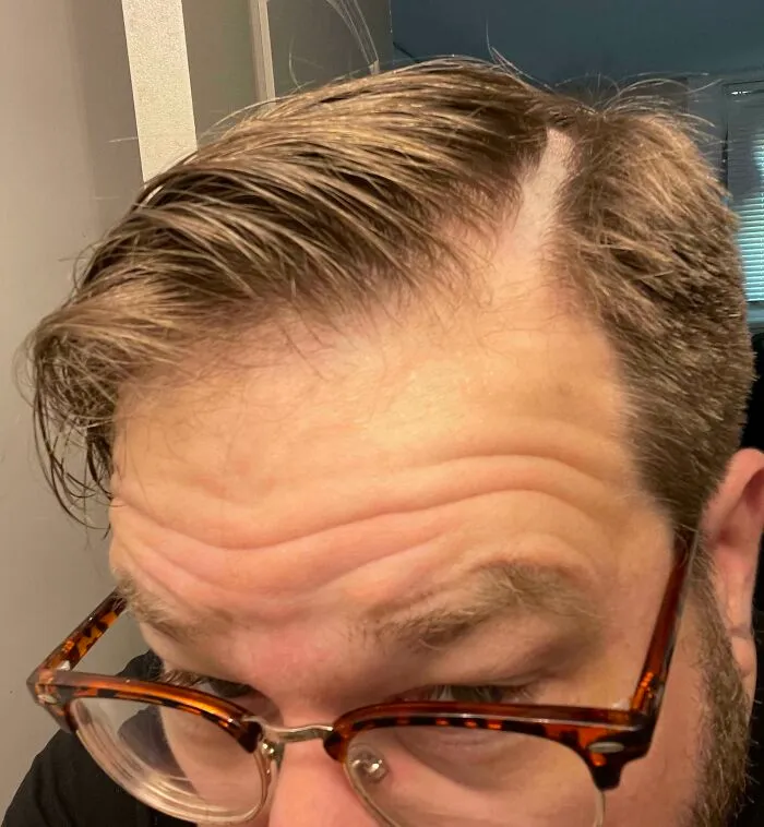 Went To A New Barber. Asked For My Part To Be Cut In. She Mowed A F*****g 1/2” Stripe Out Of My Head!