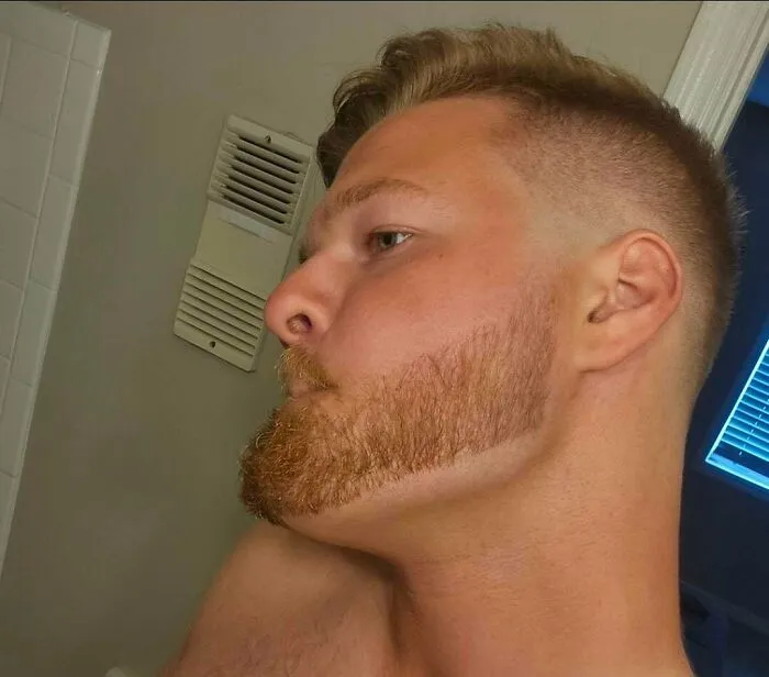 A man with a poorly blended haircut and beard, highlighting a hair salon disaster.