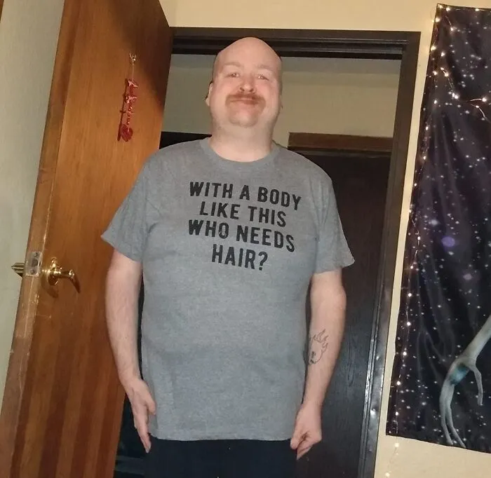 Wearing Confidence Like A Second Skin, The <span Style="Font: Inherit; Color: #d74b1f;"> "With A Body Like This, Who Needs Hair" T-Shirt </Span> Is Dad's Way Of Letting Everyone Know He Has Fully Made Peace With The Situation And Is Thriving