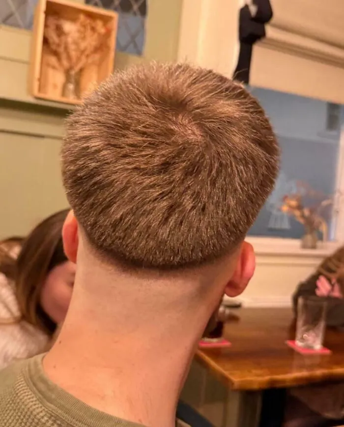 This Was A 'Skin Fade'. I Got As Far As The Pub, My Mates Took This Picture And Promptly Ushered Me Back To Their House To Fix It