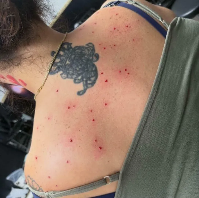 ¿Cuál es peor, los tatuajes de corazones que parecen granos o el garabato de la corona?