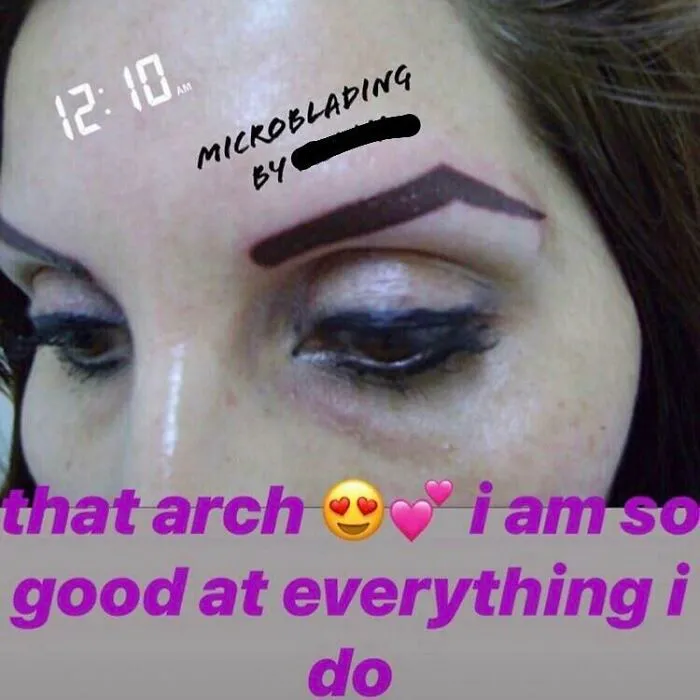 A close-up of a woman's face with poorly microbladed eyebrows that are thick, dark, and uneven, from a beauty salon.