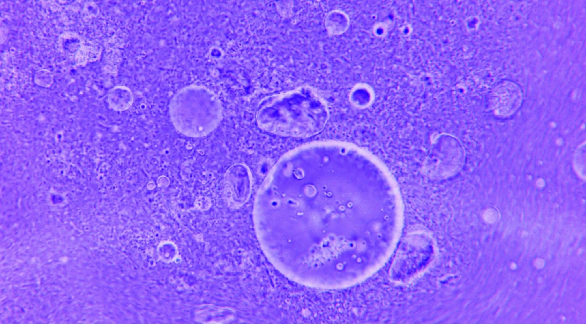 Microscopic image of purple somatic cells undergoing cell division, revealing various stages of cellular processes.